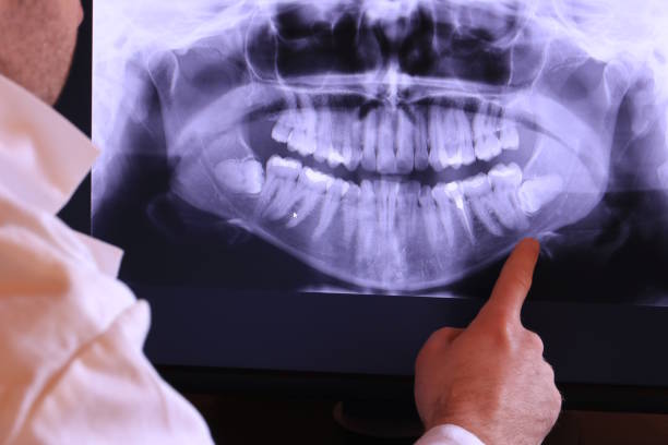Best Broken or Cracked Tooth Emergency Dentist in Roseburg Nth, OR