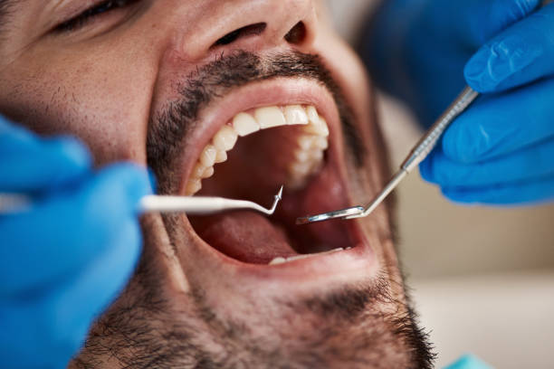 Best Emergency Dentist for Knocked-Out Tooth in Roseburg Nth, OR