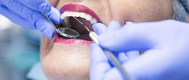 Best Emergency Dental Care for Abscessed Tooth in Roseburg Nth, OR